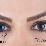 لنز رنگی بوش اند لومب topaz