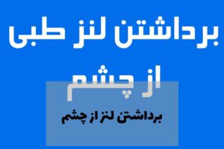 برداشتن لنز از چشم