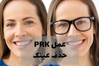عمل حذف عینک