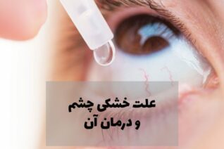 خشکی چشم و راه درمان خشکی چشم