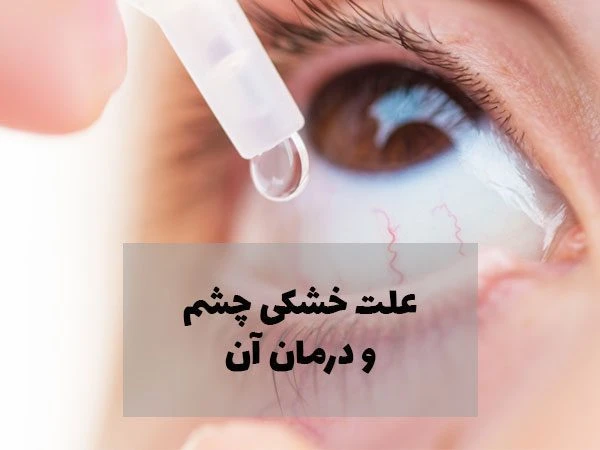 علت خشکی چشم و روش های درمان خشکی چشم