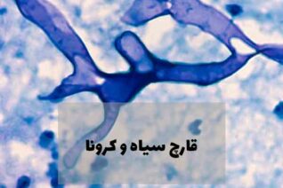 قارچ سیاه یک عفونت قارچی جدی اما نادر است که توسط گروه قارچ های "Mucormycetes" ایجاد می شود.