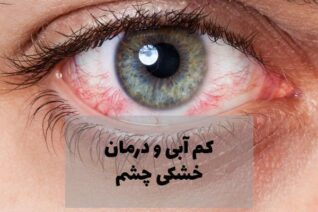 خشکی چشم یکی عارضه شایع بین افراد است، در این مقاله روش های درمان خشکی چشم را شرح داده ایم.
