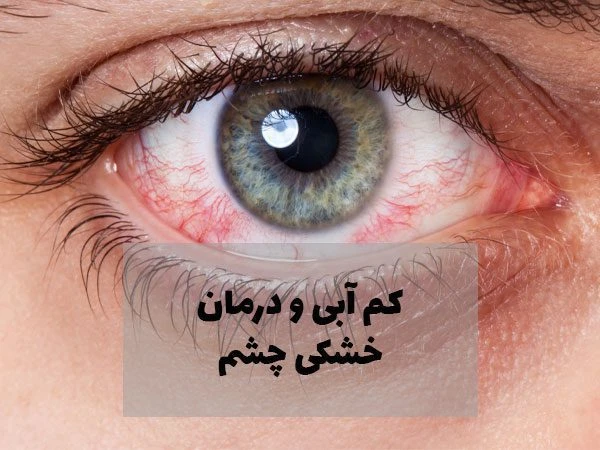 تاثیر کم آبی بدن بر چشم، راه های درمان آن