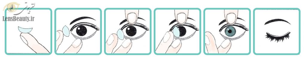 گذاشتن لنز در چشم