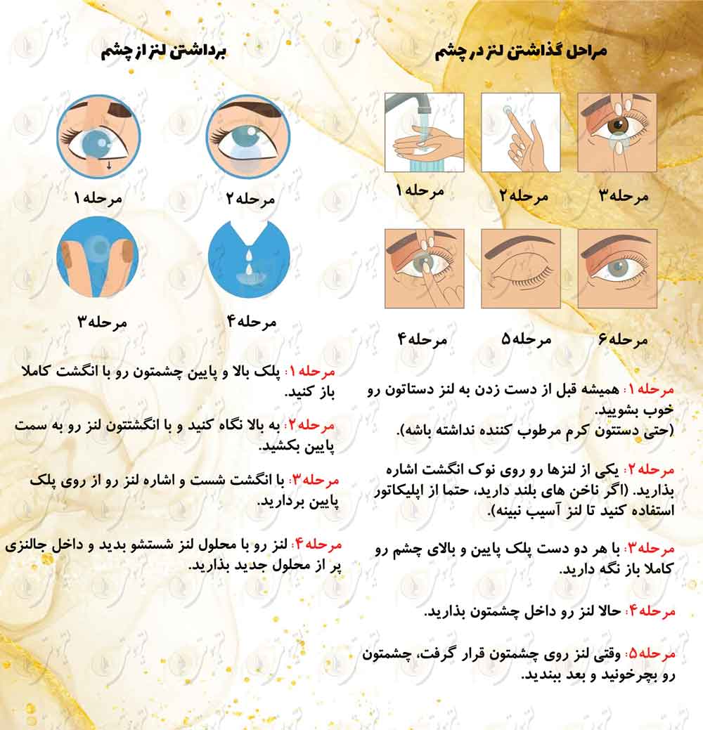 آموزش گذاشتن لنز
آموزش برداشتن لنز