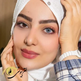 لنز یونیک رنگ لوتوس